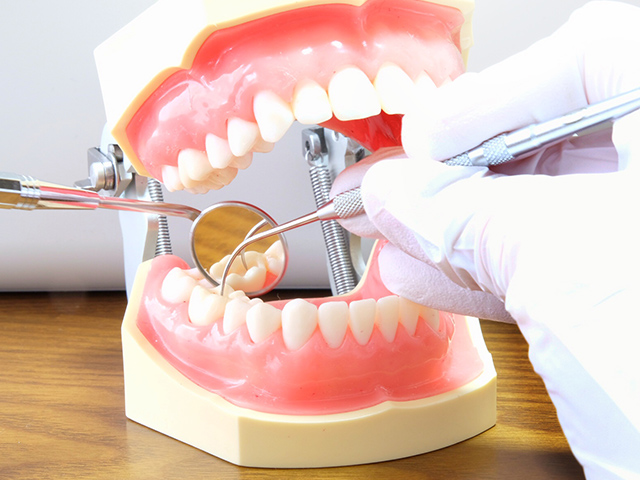 歯の模型で治療するイメージ